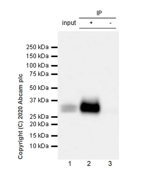 Immunoprecipitation - Anti-ULBP2 antibody [EPR22303-124] - BSA and Azide free (AB275034)