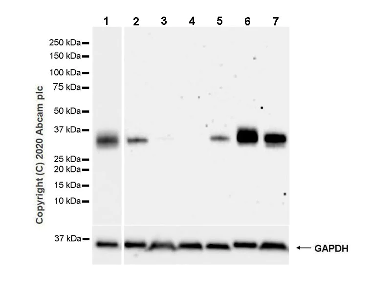 Western blot - Anti-ULBP2 antibody [EPR22303-124] - BSA and Azide free (AB275034)