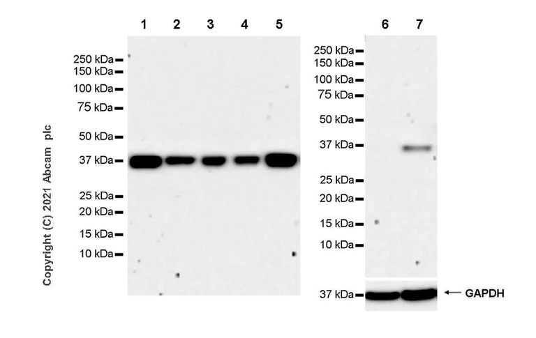 Western blot - Anti-ULBP2 + RAET1G antibody [EPR24077-5] - BSA and Azide free (AB280890)