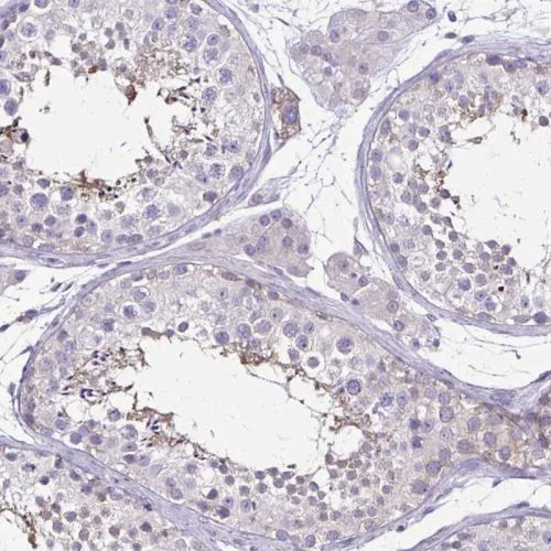 Immunohistochemistry (Formalin/PFA-fixed paraffin-embedded sections) - Anti-ULBP3 antibody (AB244525)