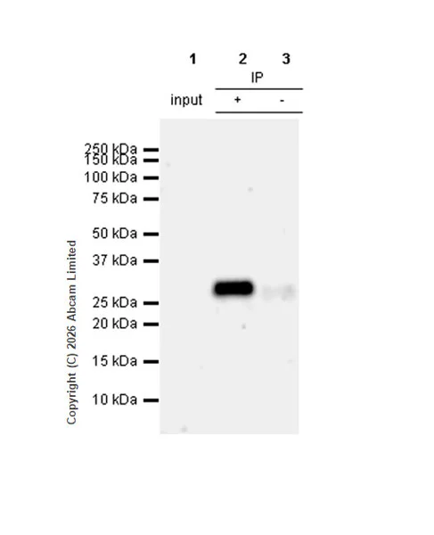 Immunoprecipitation - Anti-ULBP3 antibody [EPR22321-99] (AB300102)