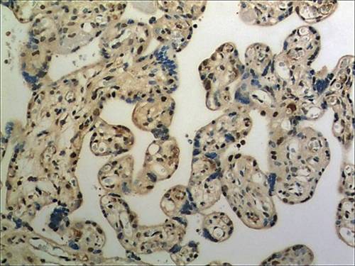 Immunohistochemistry (Formalin/PFA-fixed paraffin-embedded sections) - Anti-ULBP3 antibody [MM0594-6E12] (AB89931)