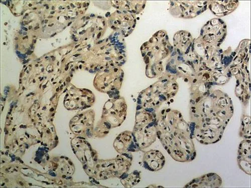 Immunohistochemistry (Formalin/PFA-fixed paraffin-embedded sections) - Anti-ULBP3 antibody [MM0594-6E12] (AB89931)
