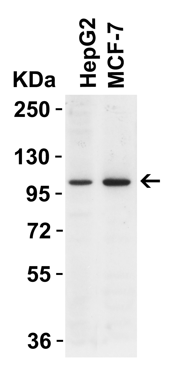 Western blot - Anti-ULK1 antibody (AB167139)