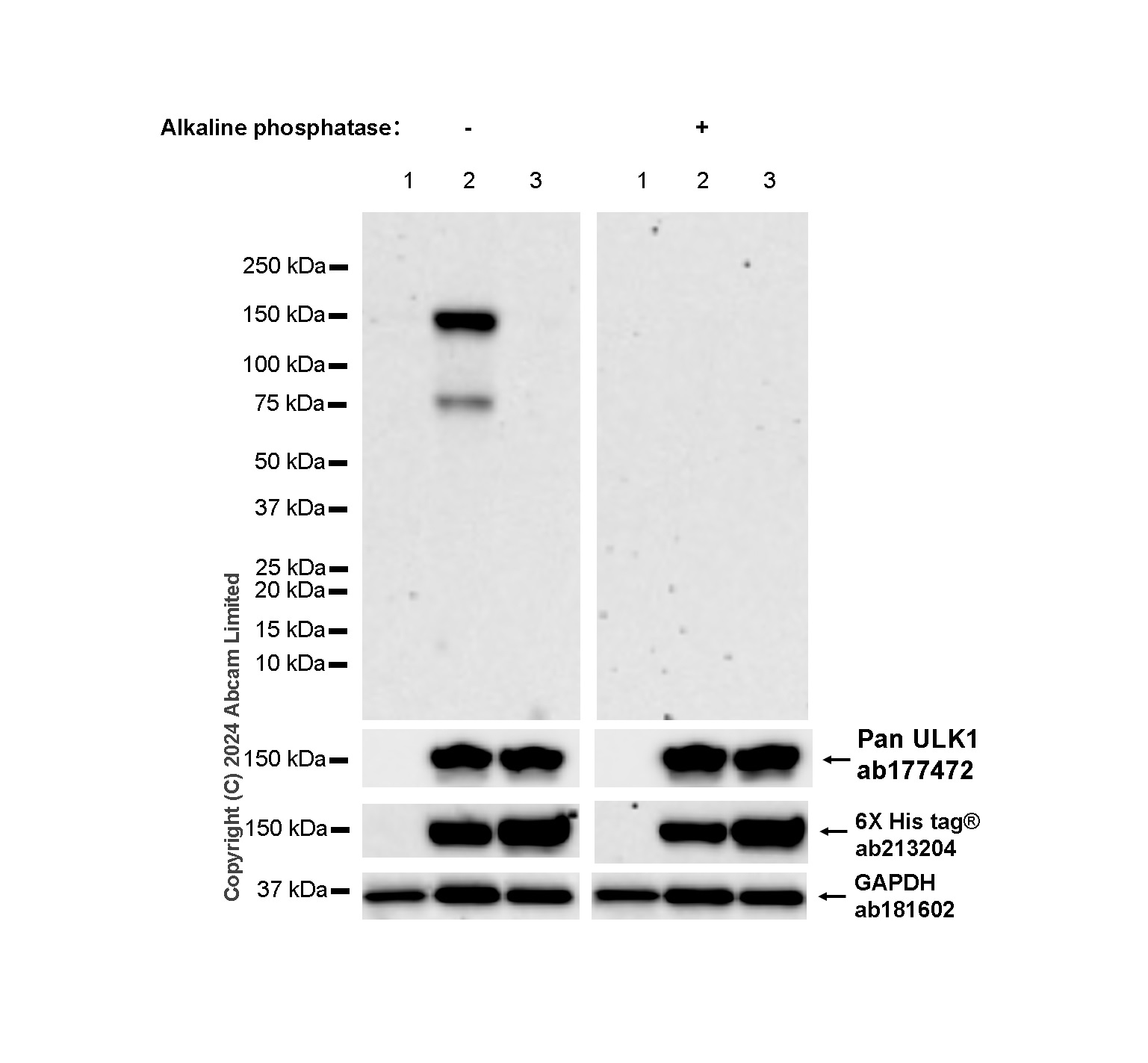 Western blot - Anti-ULK1 antibody [EPR6153(2)] (AB177472), expandable thumbnail