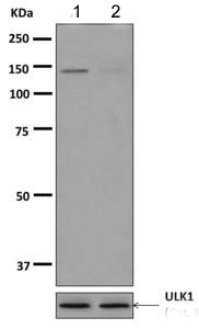 Western blot - Anti-ULK1 (phospho S450) antibody [EPR6152] - BSA and Azide free (AB249223), expandable thumbnail