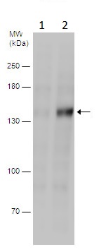 Western blot - Anti-ULK1 (phospho S555) antibody (AB229537), expandable thumbnail