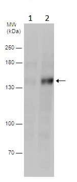 Western blot - Anti-ULK1 (phospho S555) antibody (AB229537)