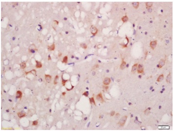 Immunohistochemistry (Formalin/PFA-fixed paraffin-embedded sections) - Anti-ULK1 (phospho S556) antibody (AB203207)