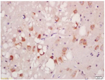 Immunohistochemistry (Formalin/PFA-fixed paraffin-embedded sections) - Anti-ULK1 (phospho S556) antibody (AB203207)