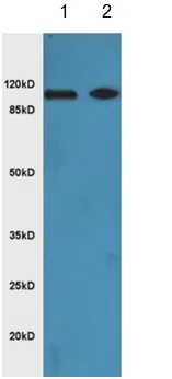 Western blot - Anti-ULK1 (phospho S556) antibody (AB203207)