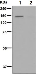 Western blot - Anti-ULK1 (phospho S638) antibody [EPR6155] - BSA and Azide free (AB248647)