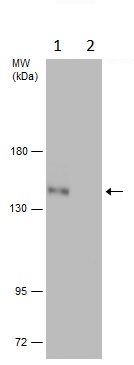 Western blot - Anti-ULK1 (phospho S758) antibody (AB229581)