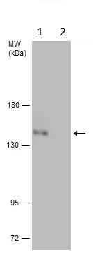 Western blot - Anti-ULK1 (phospho S758) antibody (AB229581)