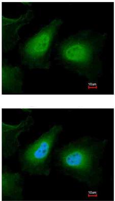 Immunocytochemistry/ Immunofluorescence - Anti-ULK2 antibody (AB97695)