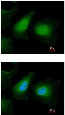 Immunocytochemistry/ Immunofluorescence - Anti-ULK2 antibody (AB97695)