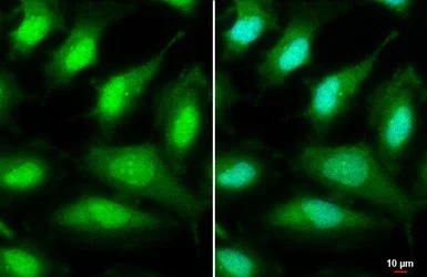 Immunocytochemistry/ Immunofluorescence - Anti-ULK2 antibody (AB97695)