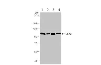 Western blot - Anti-ULK2 antibody (AB97695)