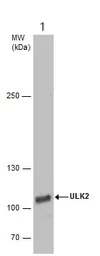 Western blot - Anti-ULK2 antibody (AB97695)