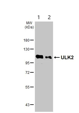 Western blot - Anti-ULK2 antibody (AB97695)
