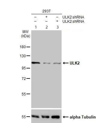 Western blot - Anti-ULK2 antibody (AB97695)