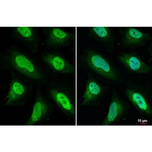 Immunocytochemistry/ Immunofluorescence - Anti-ULK2 antibody [HL2206] (AB317161)