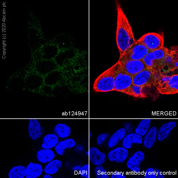 Immunocytochemistry/ Immunofluorescence - Anti-ULK3 antibody [EPR4888] (AB124947)