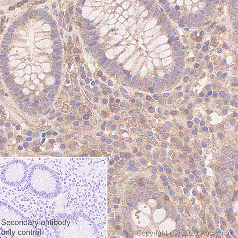 Immunohistochemistry (Formalin/PFA-fixed paraffin-embedded sections) - Anti-ULK3 antibody [EPR4888] (AB124947)