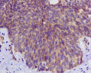 Immunohistochemistry (Formalin/PFA-fixed paraffin-embedded sections) - Anti-ULK3 antibody [EPR4888] (AB124947)
