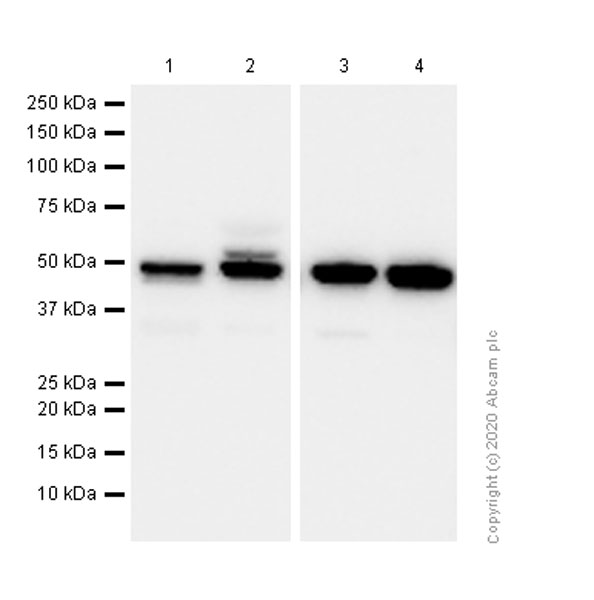 Western blot - Anti-ULK3 antibody [EPR4888] (AB124947)