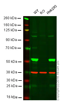 Western blot - Anti-ULK3 antibody [EPR4888] (AB124947)
