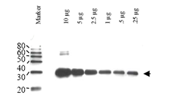 Western blot - Anti-ULP-1 antibody (AB34668), expandable thumbnail