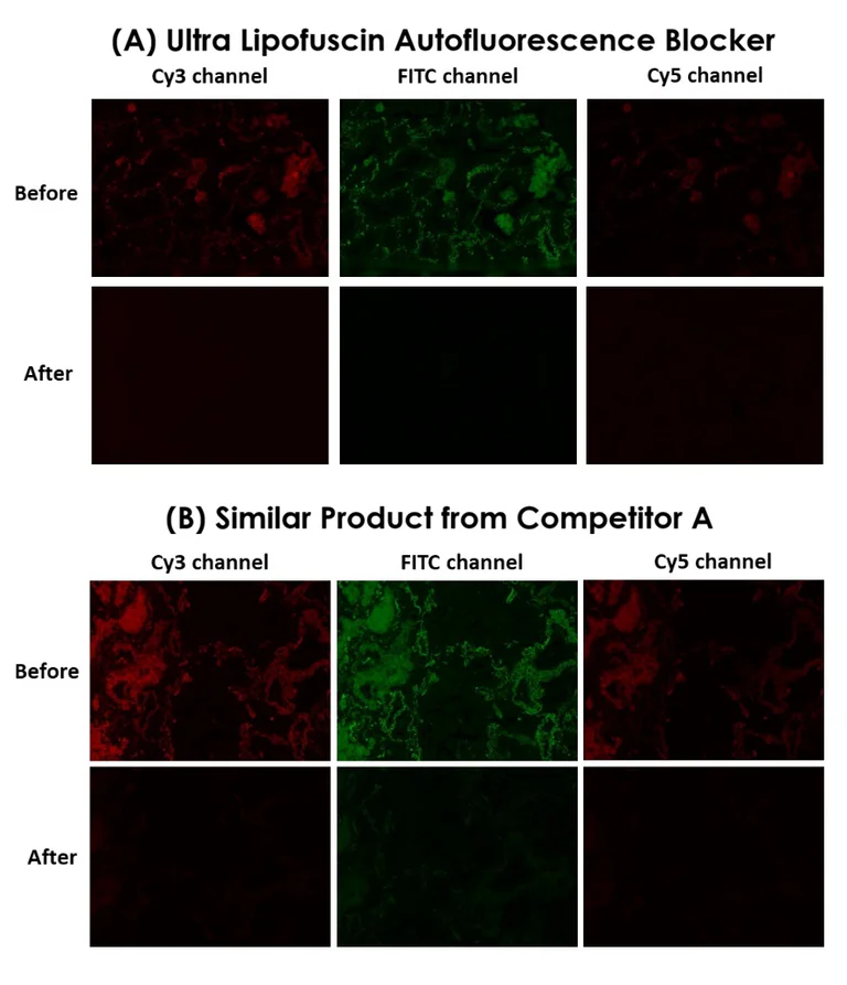 Immunofluorescence - Ultra Lipofuscin Autofluorescence Blocker (AB327364)