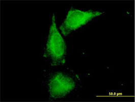 Immunocytochemistry/ Immunofluorescence - Anti-UMOD antibody (AB167678), expandable thumbnail
