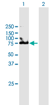 Western blot - Anti-UMOD antibody (AB167678), expandable thumbnail