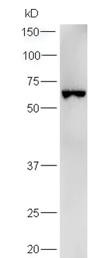 Western blot - Anti-UMOD antibody (AB217354)