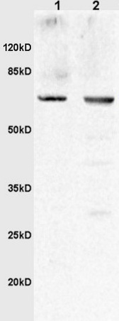 Western blot - Anti-UMOD antibody (AB217354)
