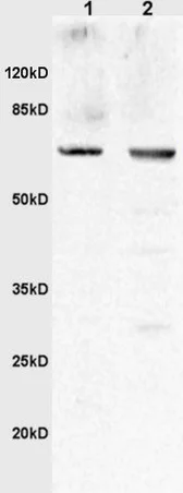 Western blot - Anti-UMOD antibody (AB217354)
