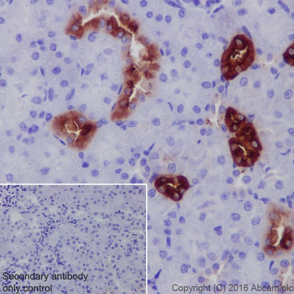 Immunohistochemistry (Formalin/PFA-fixed paraffin-embedded sections) - Anti-UMOD antibody [EPR20071] (ab207170), expandable thumbnail