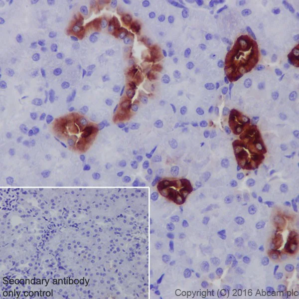 Immunohistochemistry (Formalin/PFA-fixed paraffin-embedded sections) - Anti-UMOD antibody [EPR20071] (AB207170)