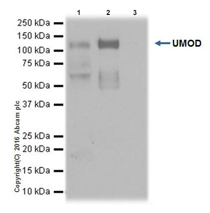 Immunoprecipitation - Anti-UMOD antibody [EPR20071] (AB207170), expandable thumbnail