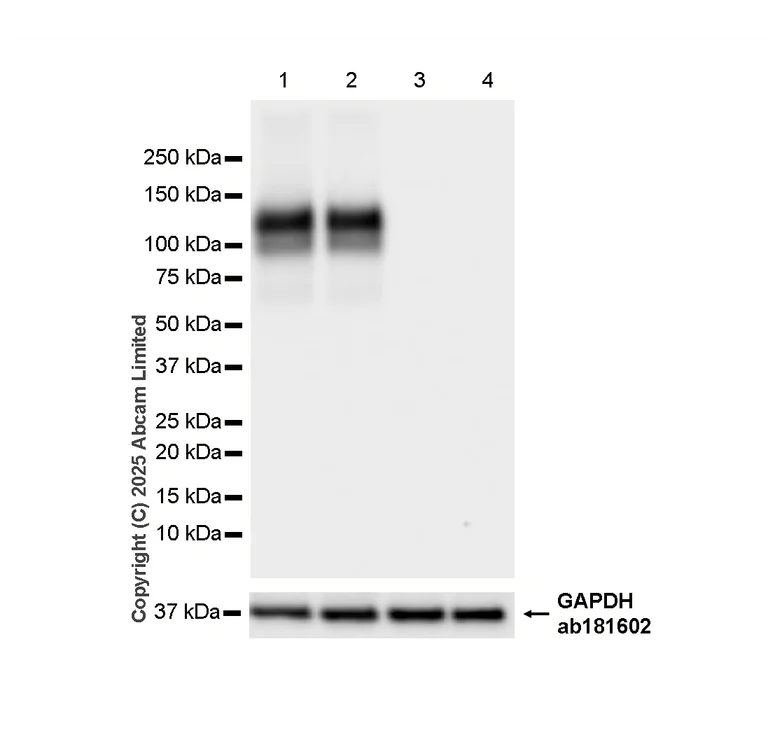Western blot - Anti-UMOD antibody [EPR20071] - BSA and Azide free (AB223540)