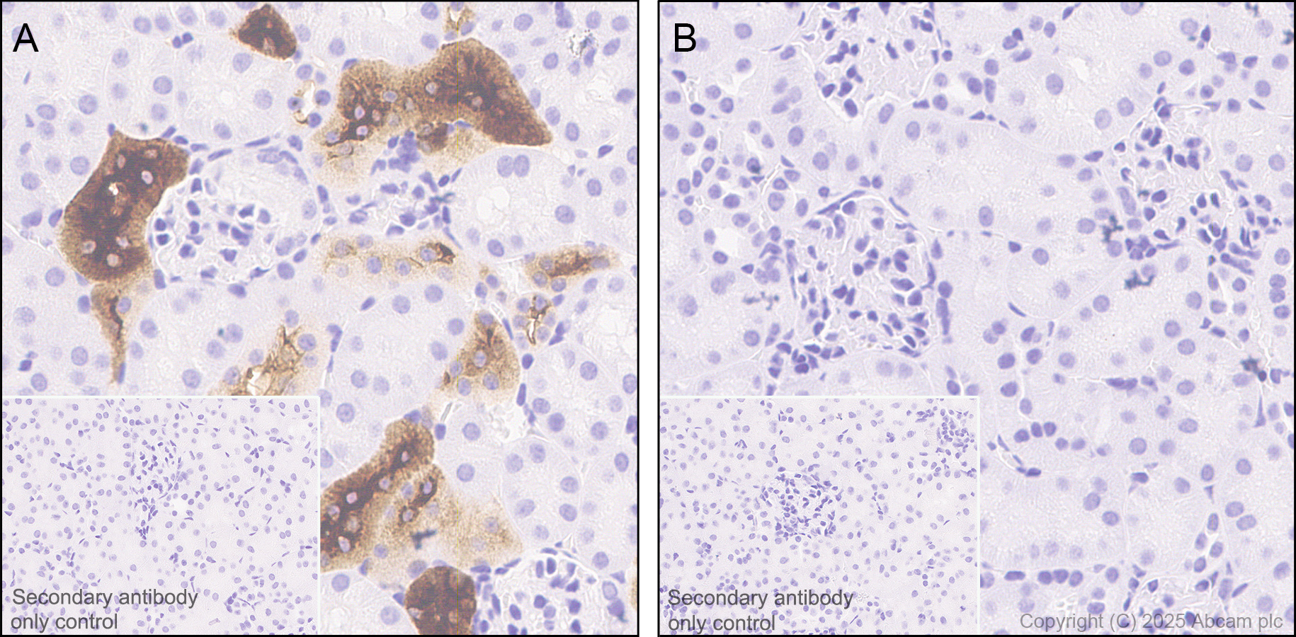 Immunohistochemistry (Formalin/PFA-fixed paraffin-embedded sections) - Anti-UMOD antibody [EPR22887-217] (AB255825)