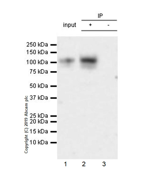 Immunoprecipitation - Anti-UMOD antibody [EPR22887-217] (AB255825), expandable thumbnail