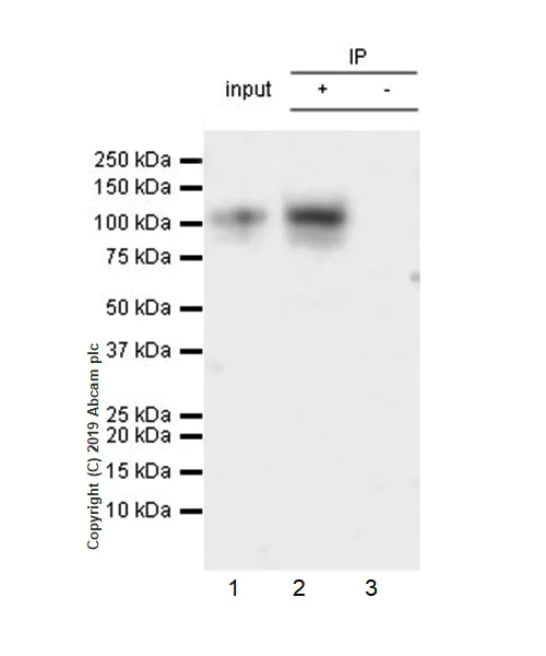 Immunoprecipitation - Anti-UMOD antibody [EPR22887-217] (AB255825)