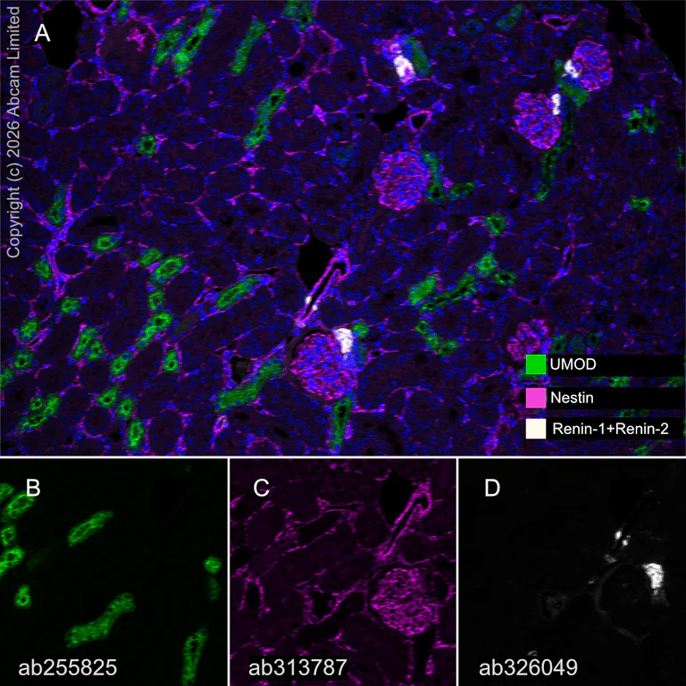 Multiplex immunohistochemistry - Anti-UMOD antibody [EPR22887-217] (AB255825)