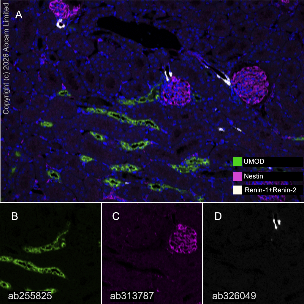 Multiplex immunohistochemistry - Anti-UMOD antibody [EPR22887-217] (AB255825)