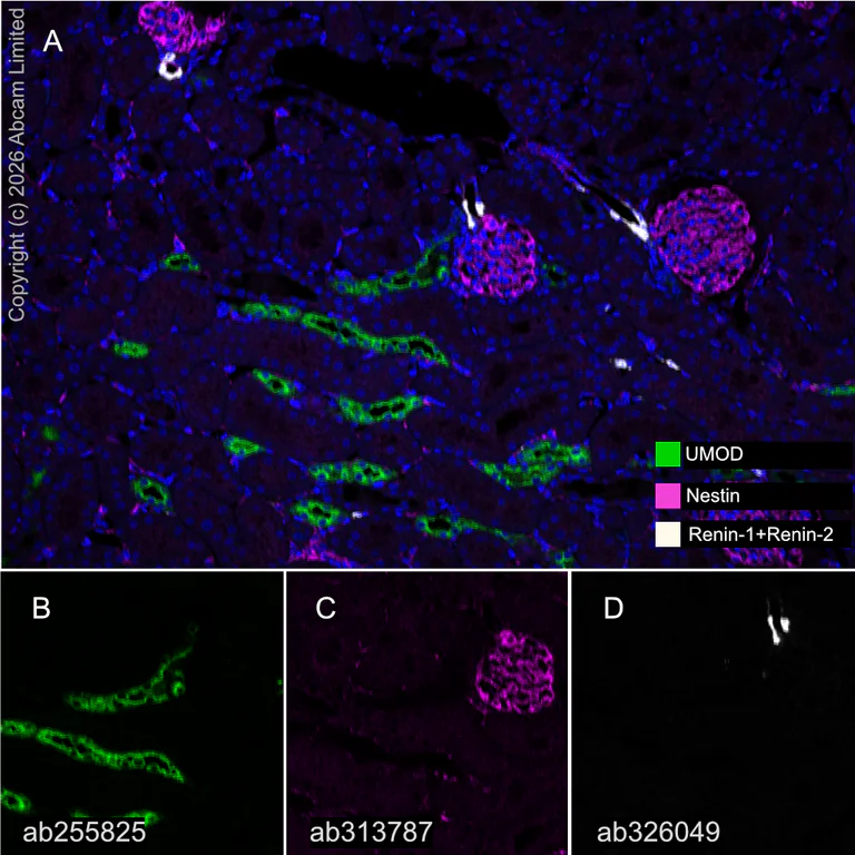 Multiplex immunohistochemistry - Anti-UMOD antibody [EPR22887-217] (AB255825)