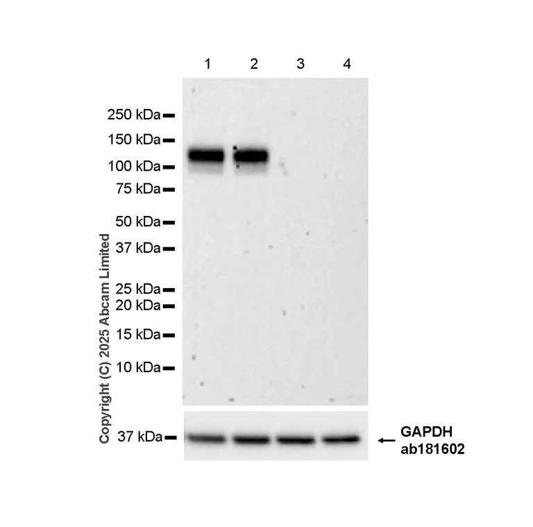 Western blot - Anti-UMOD antibody [EPR22887-217] (AB255825)