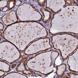 Immunohistochemistry (Formalin/PFA-fixed paraffin-embedded sections) - Anti-UNC119-binding protein C5orf30 antibody (AB150906)